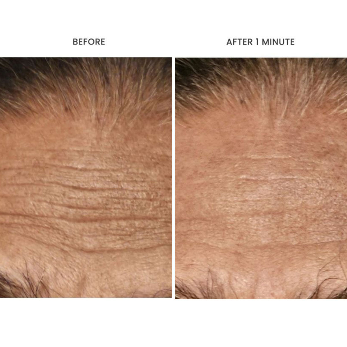 Advanced restorative cream results before and after showing immediate wrinkle reduction in one minute.