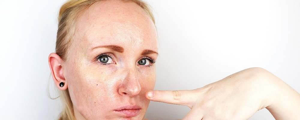 Why Is My Skin So Red