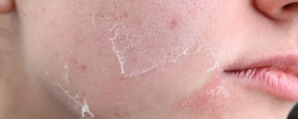 Exfoliating 101: Why are so many people doing it wrong?