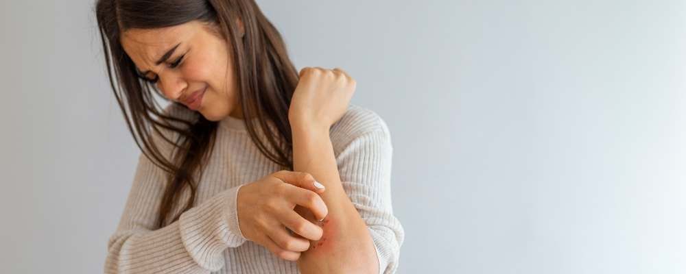 What You Need to Know About Psoriasis