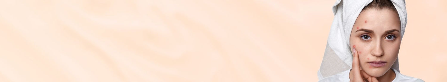 Skin Concern Acne Treatment &amp; Prevention
